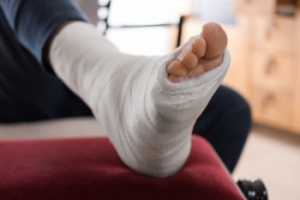 Recognizing and Treating a Fractured Foot Bone