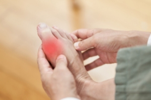 Symptoms and Management of Early Onset Gout