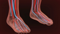 Causes and Symptoms of Poor Circulation in the Feet